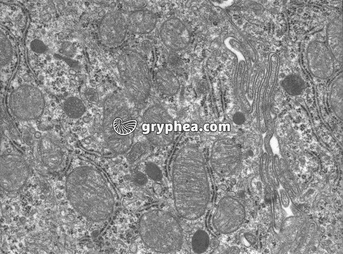 Mitochondries à crêtes MET x17000 - gryphea.com